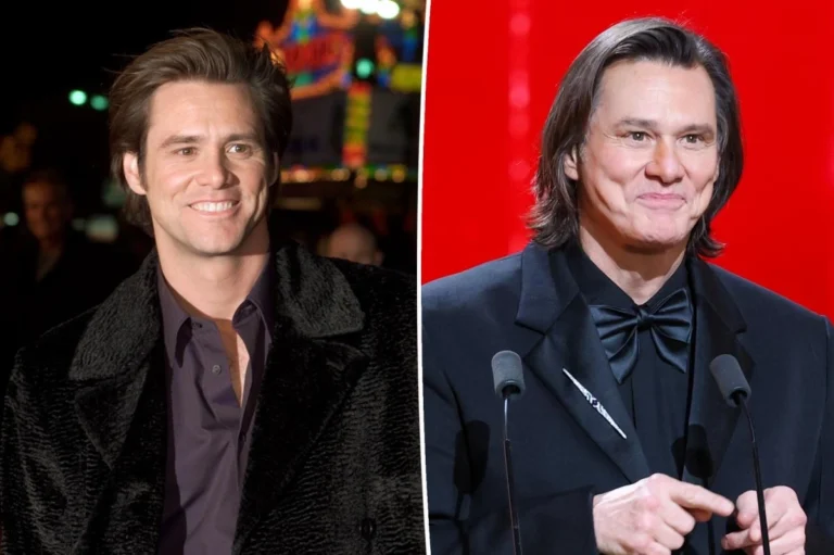 Jim Carrey difeso da chirurgo estetico per il suo nuovo look criticato